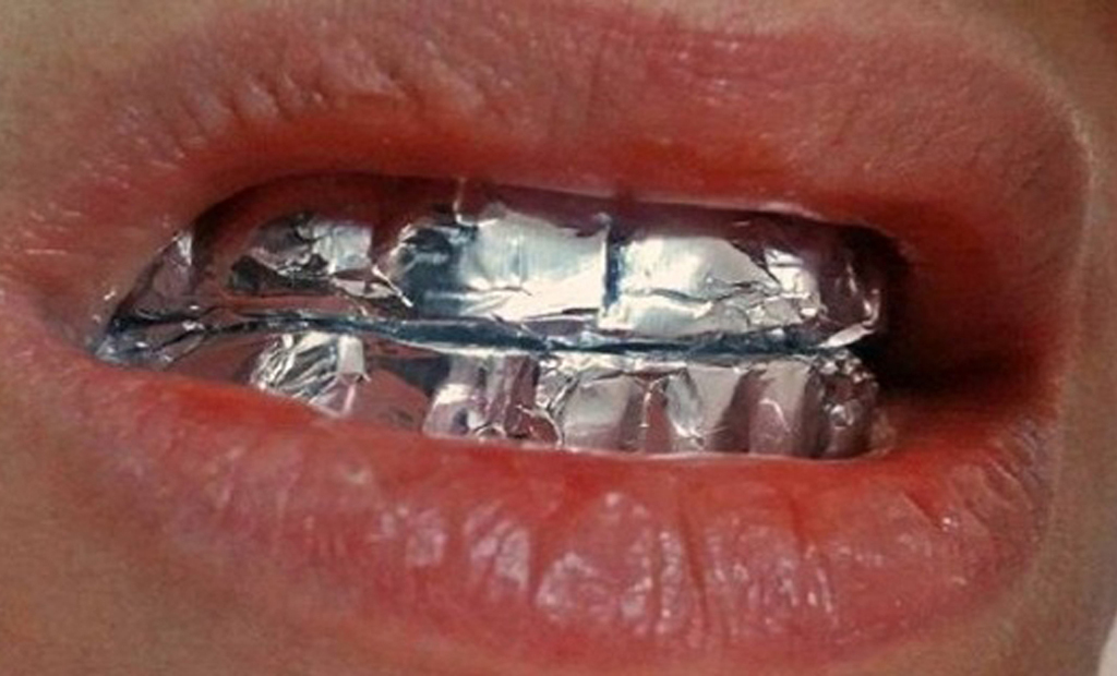 Pearly Whites You've Always Wanted Foil wrapped around teeth
