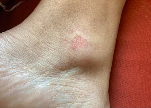 paw imprint on ankle