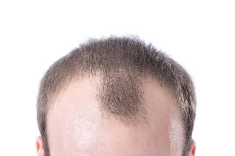 Hair Health Hair Health
