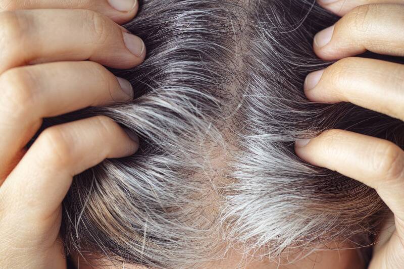 Hair health Hair health