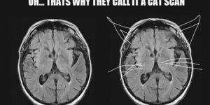 Why it’s called a cat scan.