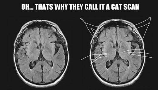 Why it's called a cat scan.