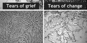 The Structure Of A Tear