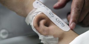 Growing an ear on the arm of a patient who lost his right ear at Xi’an Jiaotong University.