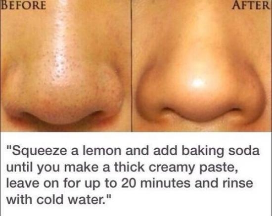 How to remove blackheads.