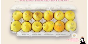 Signs Of Breast Cancer Explained; Using Lemons