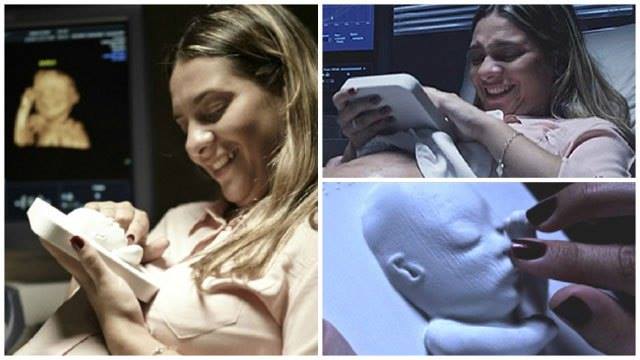 3D Printout of an ultrasound for a blind expecting mother