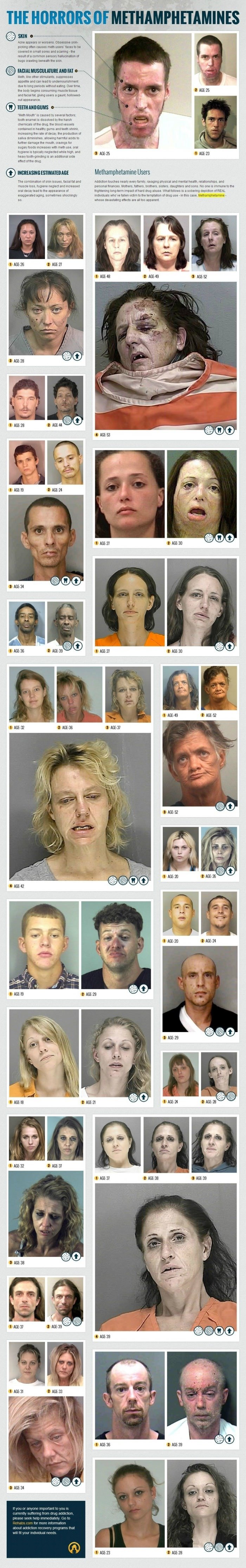 A few reasons to avoid methamphetamines.