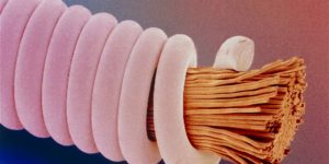Microscopic picture of a guitar string