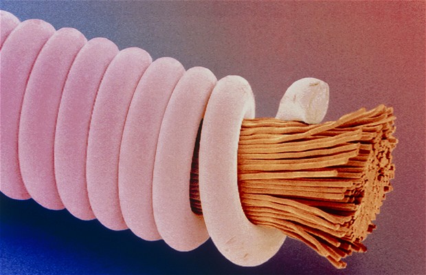 Microscopic picture of a guitar string