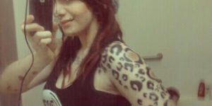 This girl was born with a skin pigmentation disorder so she tattooed them into cheetah spots