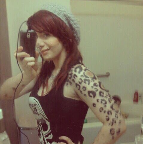 This girl was born with a skin pigmentation disorder so she tattooed them into cheetah spots