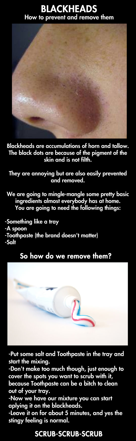 Dealing with blackheads.