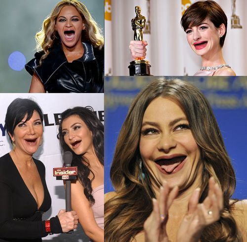Celebrities without teeth.