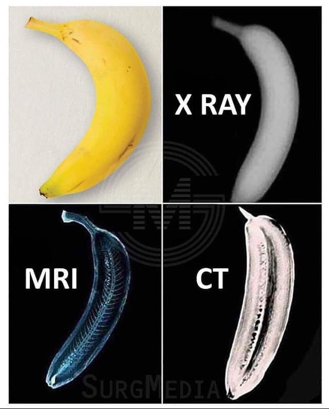 Banana for scan.