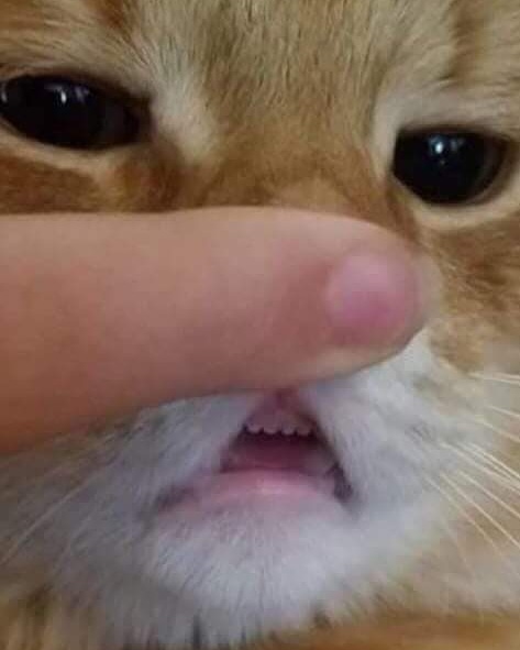 teefers