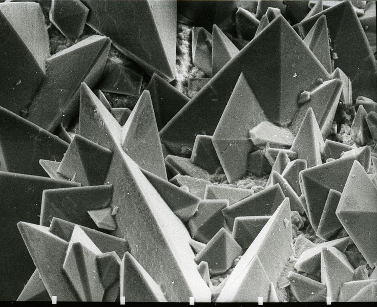 A kidney stone under an electron microscope.