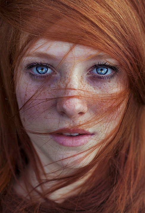 Freckled.