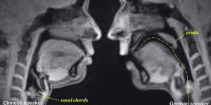 MRI of two people speaking