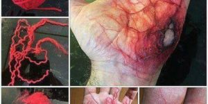 Blood vessel makeup technique
