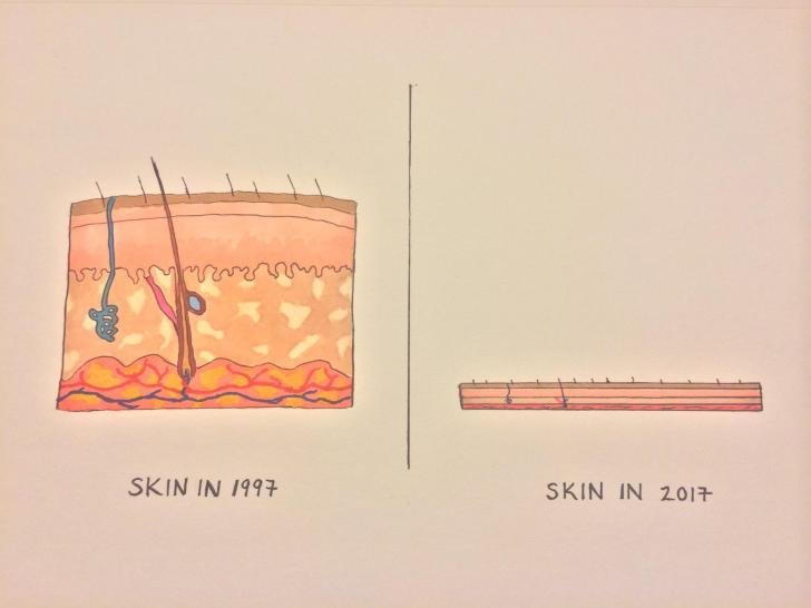 Skin, then and now.