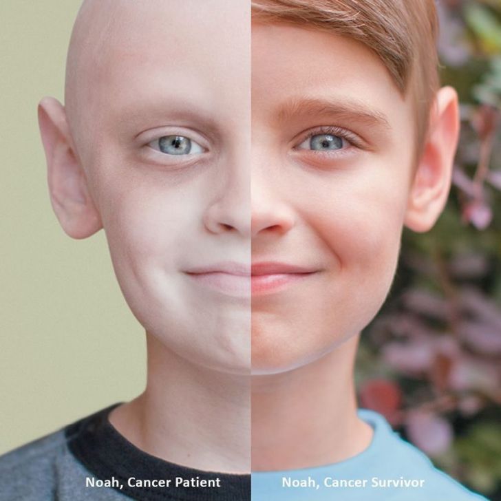 Then and Now: Cancer patient vs. Cancer survivor.