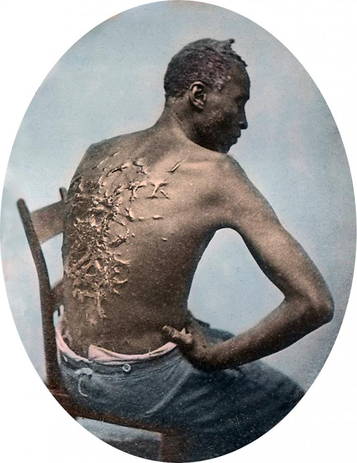Escaped slave, 1863