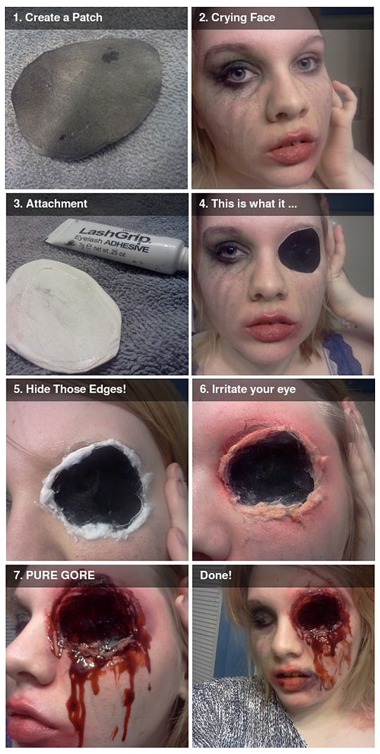 How to lose an eye.