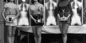 Winners of the Miss Beautiful Spine contest, cervical 1956.