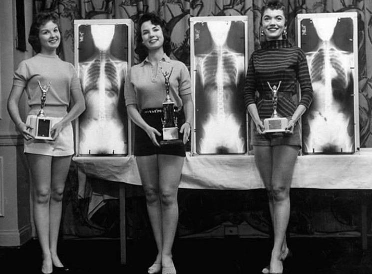 Winners of the Miss Beautiful Spine contest, cervical 1956.