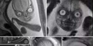 MRI reveal the demons inside us…