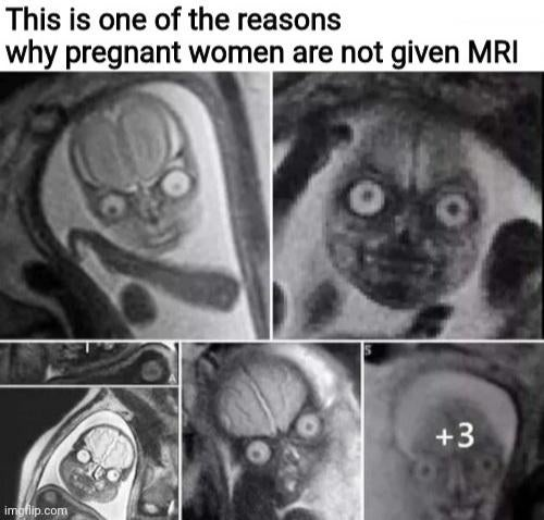 MRI reveal the demons inside us...