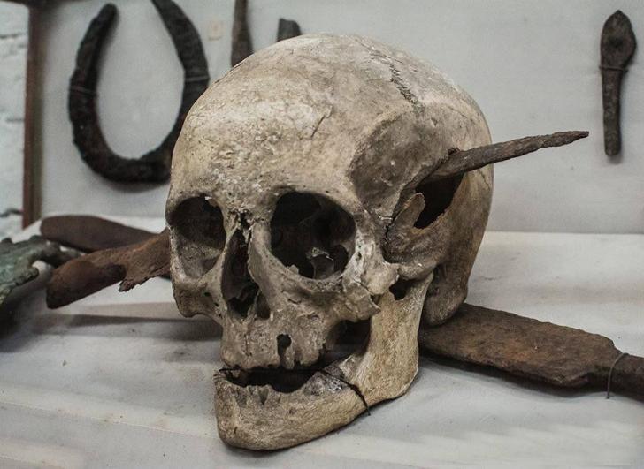 Skull of a Roman solider who died during the Gallic Wars, 1st century BC.