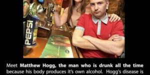 Matthew Hogg the guy who is always drunk due to auto-brewer syndrome