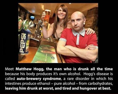 Matthew Hogg the guy who is always drunk due to auto-brewer syndrome