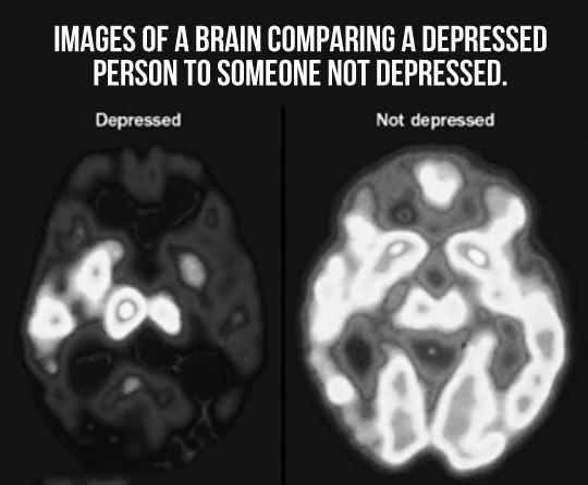 When A Brain Is Depressed