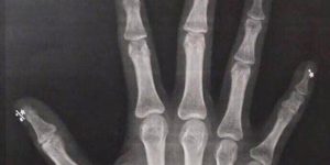 X-ray are more fun with a manicure.