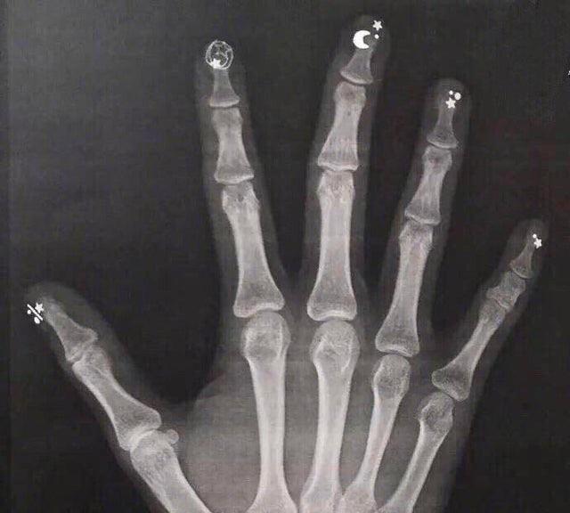 X-ray are more fun with a manicure.