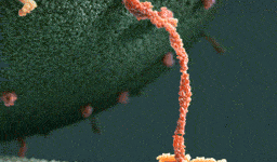 Kinesin (a motor protein) pulling a vesicle along cytoskeletal filament