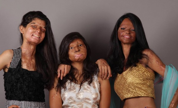 Women Who Survived Horrible Cruelty Boldly Show Off Their True Beauty As They Pose In A Photo Shoot