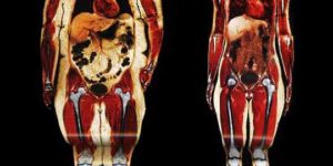 Body scans. Fat vs Fit.