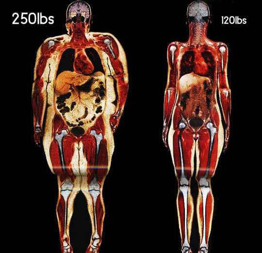 Body scans. Fat vs Fit.
