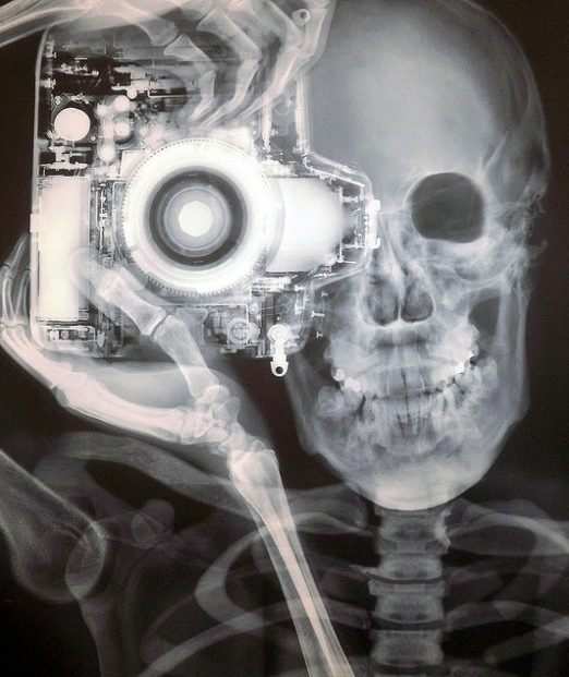 X-Ray self portrait.