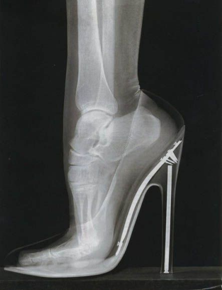 This is why high heels hurt your feet.