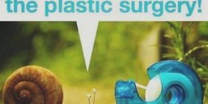 Plastic surgery