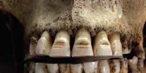 Vikings filed horizontal lines in to their teeth; no one person can say why this was done, apparently.