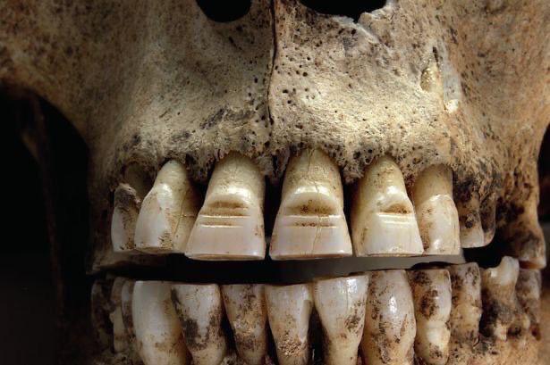 Vikings filed horizontal lines in to their teeth; no one person can say why this was done, apparently.