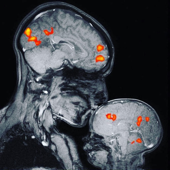 Magnetic resonance image showing a mother and child's bond. The image is of neuroscientist Rebecca Saxe kissing her two month old son.
