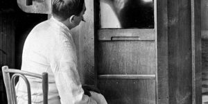 A chest X-ray in 1914