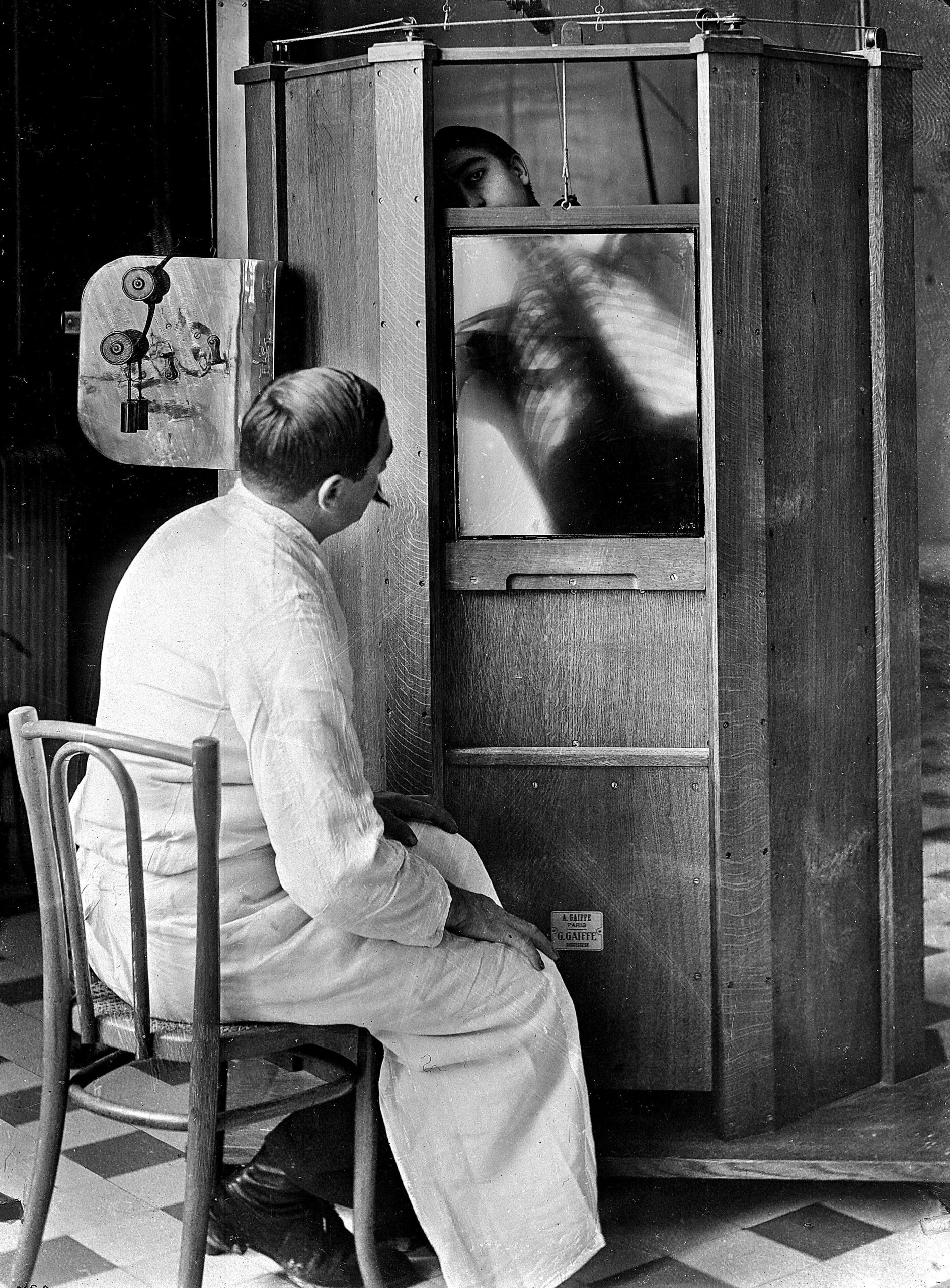 A chest Xray in 1914